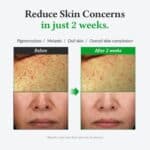 Dr.Althea - Gentle Vitamin C 20% 30ml - Image 4